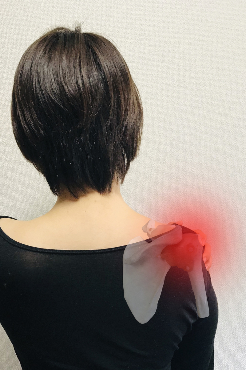 首すじではなく肩の関節や腕に痛みが出る