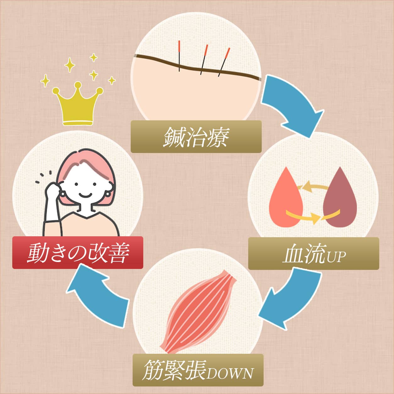 無理に動かさない!鍼 → 血流UP → 筋緊張↓ → 動かしやすくなる